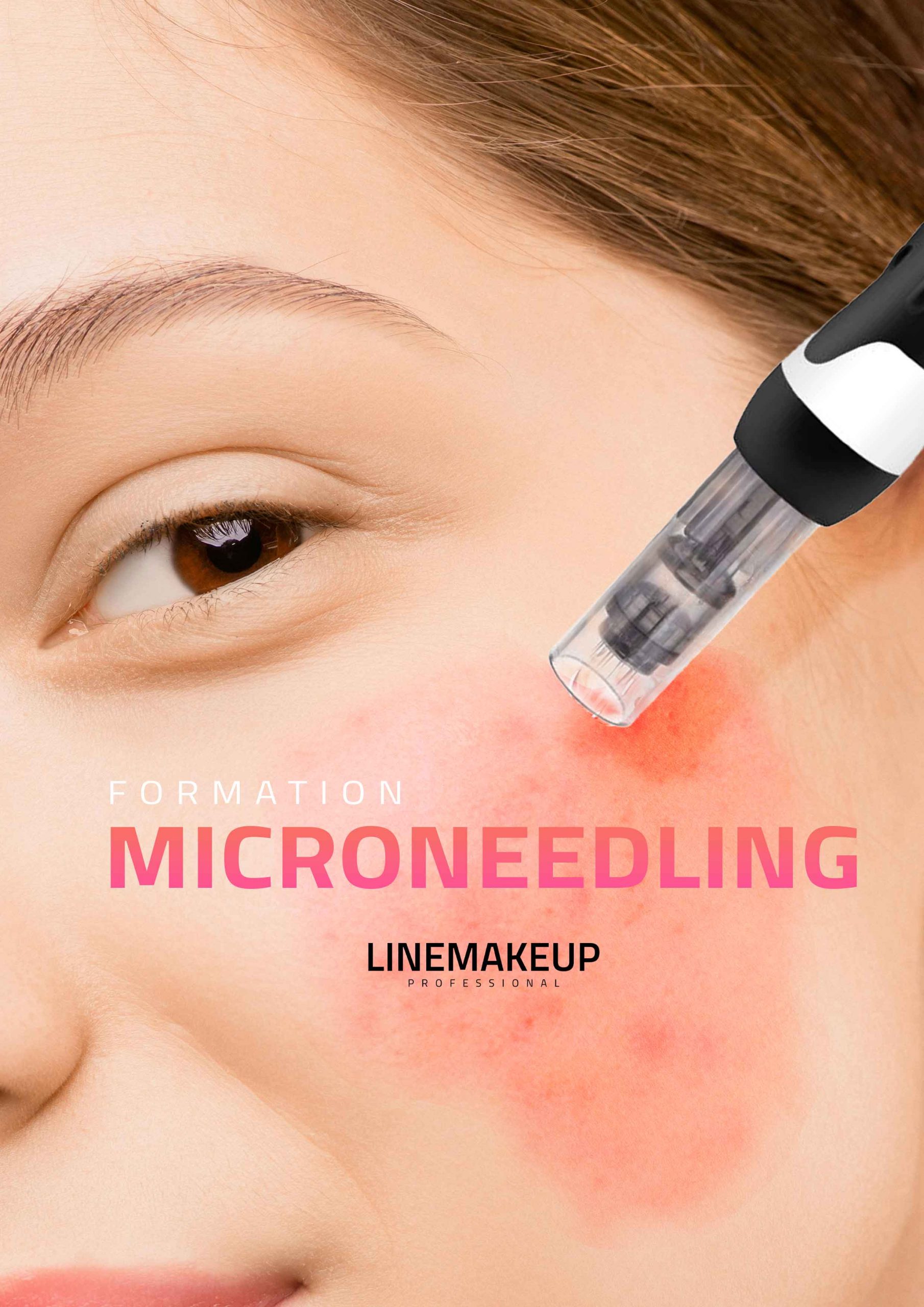 Formation-Microneedling-Linemakeup-Julia-Mechenici