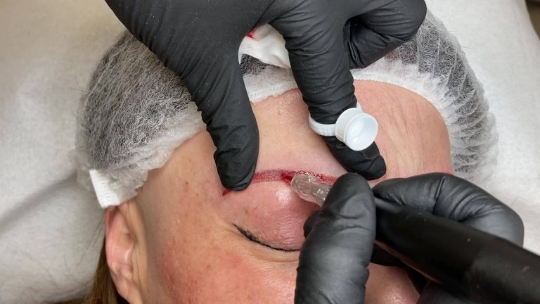 DEMO SOURCIL DROIT