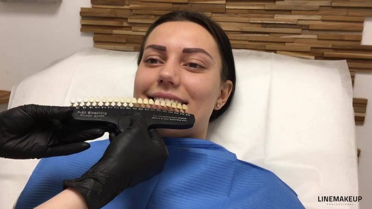 LA TEINTE DES DENTS NATURELS