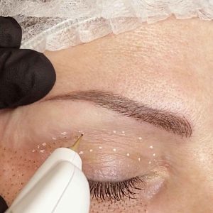 Formation Plasma lift