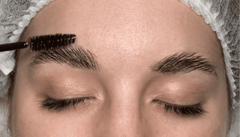 BROW LIFT