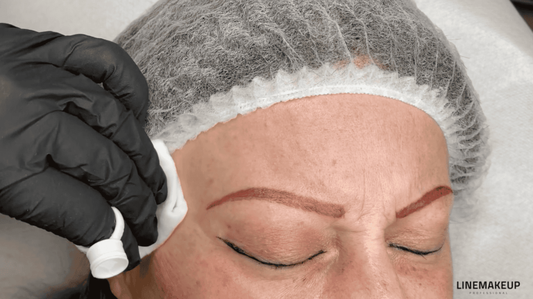 TP – DC sur le sourcil droit