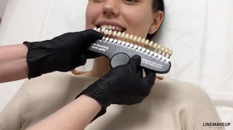 TP – Comparaison de la teinte des dents