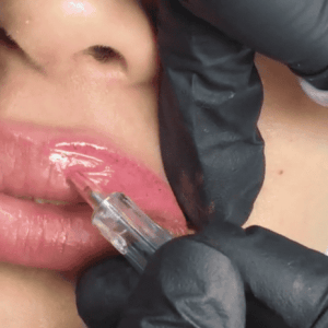 Formation Lips