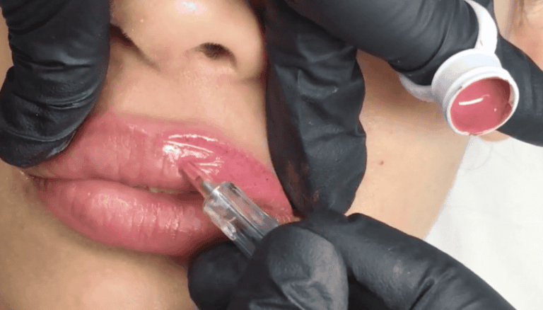 LIPS