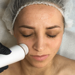Formation Brosse Rotative